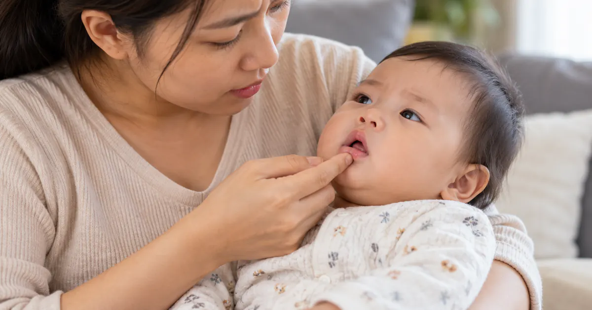 Cha mẹ theo dõi môi và độ tỉnh táo khi trẻ bú ít vì nấm miệng