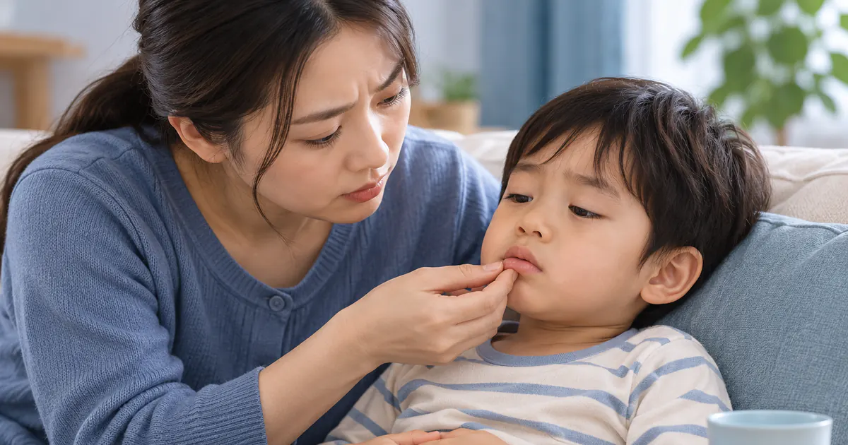 Cha mẹ quan sát môi khô và mức tỉnh táo để nhận biết dấu hiệu mất nước ở trẻ